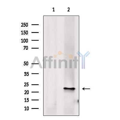 Валидация Affinity DF13743 - 9392