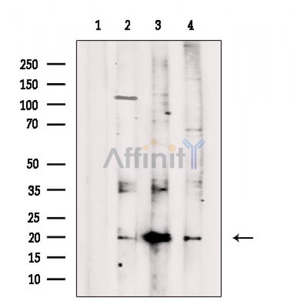 Валидация Affinity DF2425 - 13034