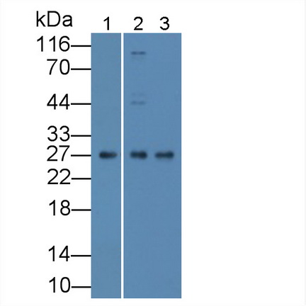 26096