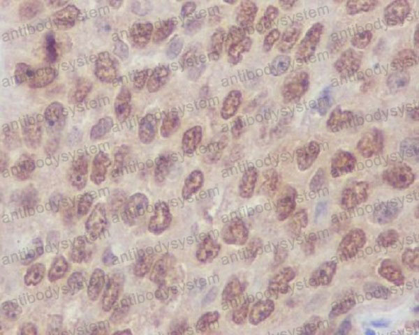 Валидация AntibodySystem RHF45101