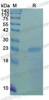 YVV45201, SDS-PAGE