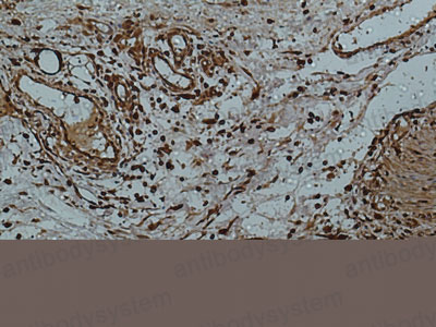 Валидация AntibodySystem RHD27110 (1448)