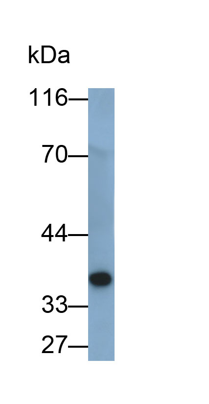 31992