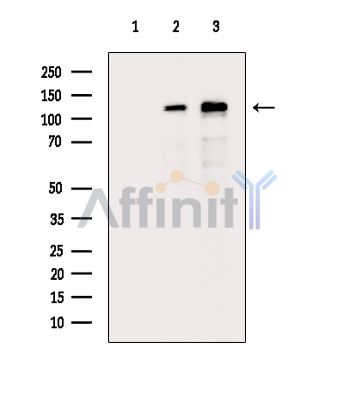 Валидация Affinity DF14124 - 9921