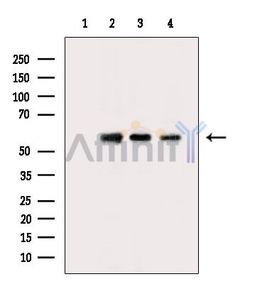 Валидация Affinity DF4387 - 15865