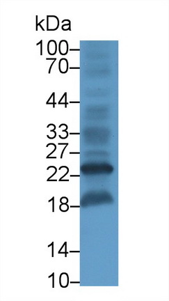 20618