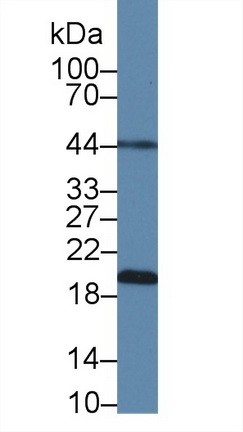 12717