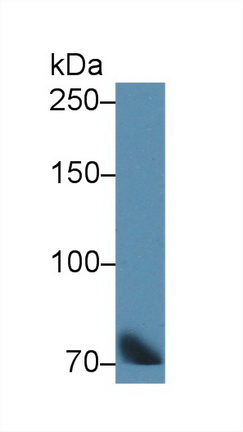 12576