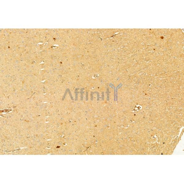 Валидация Affinity AF6426 - 3734