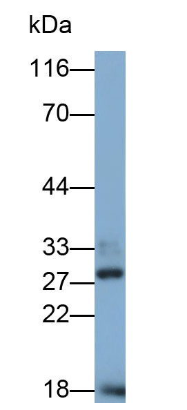31835