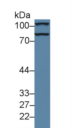13981