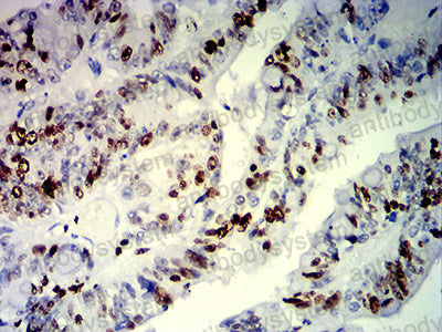 Валидация AntibodySystem RHE46104