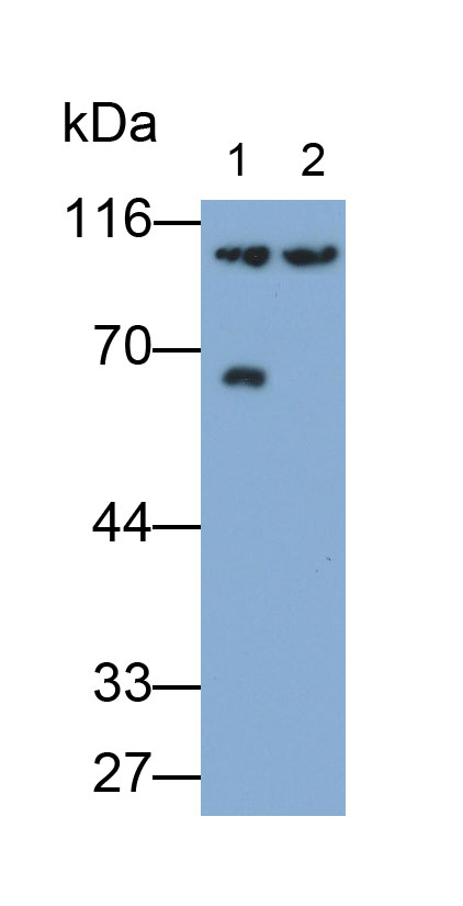31395