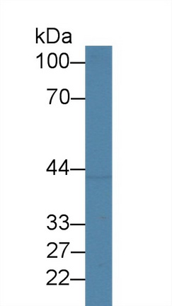 14452