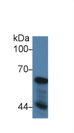 14285