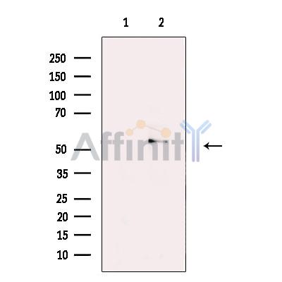 Валидация Affinity DF13323 - 8493