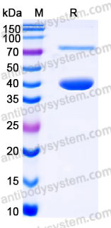 YHC83202, SDS-PAGE
