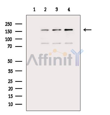 Валидация Affinity AF6028 - 3225