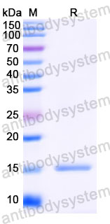 Валидация SDS-PAGE - AntibodySystem RVV23801