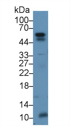 14766