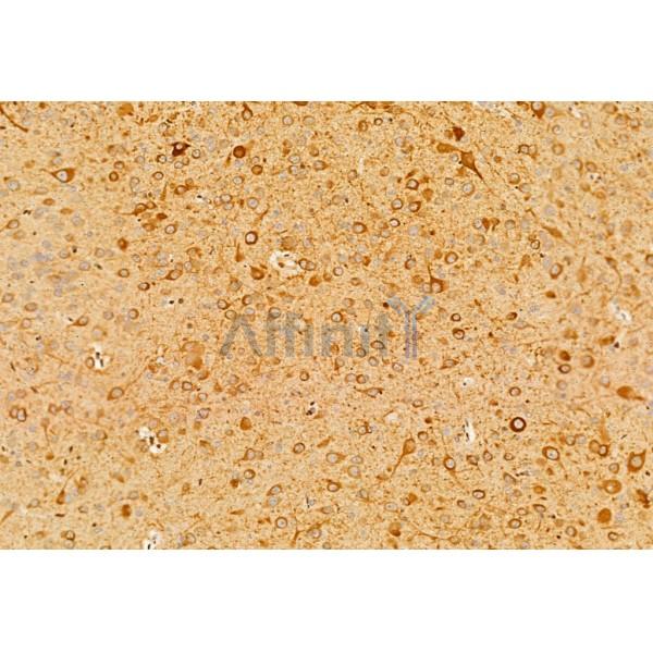 Валидация Affinity AF7011 - 4151