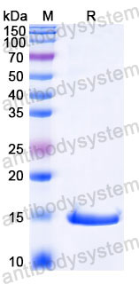 Валидация SDS-PAGE - AntibodySystem RRJ12902