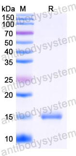 Валидация SDS-PAGE - AntibodySystem RVV19303