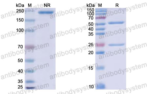 Валидация SDS-PAGE - AntibodySystem RHJ93105