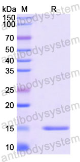 Валидация SDS-PAGE - AntibodySystem RHC08505