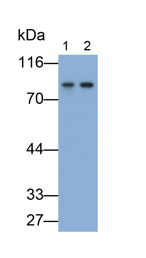 14172
