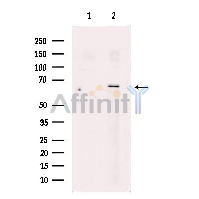 Валидация Affinity DF12108 - 6237