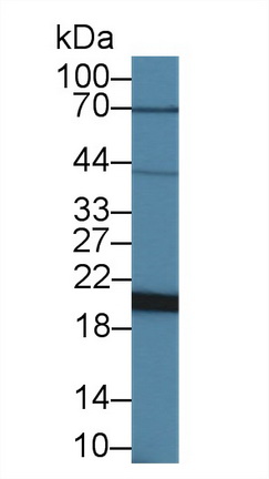 14389