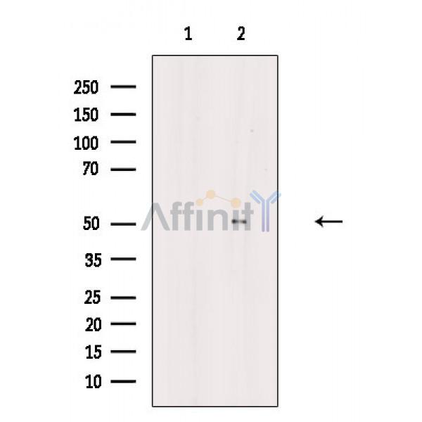 Валидация Affinity AF6849 - 4075