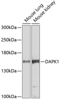 Валидация Elabscience E-AB-61095