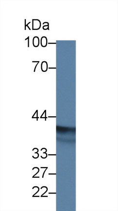 9557