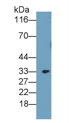 52622