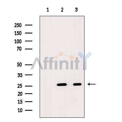 Валидация Affinity DF8529 - 20405