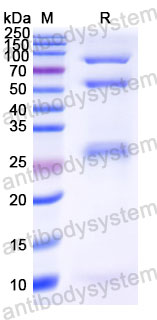 Валидация SDS-PAGE - AntibodySystem DHF92403