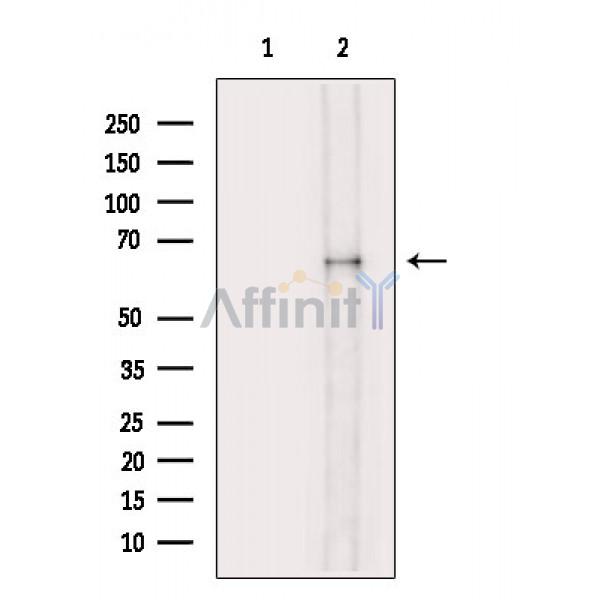 Валидация Affinity DF7657 - 19426