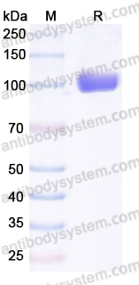 AHG01301, SDS-PAGE