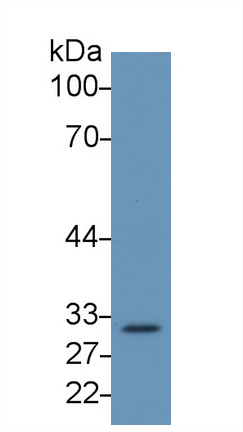 17832