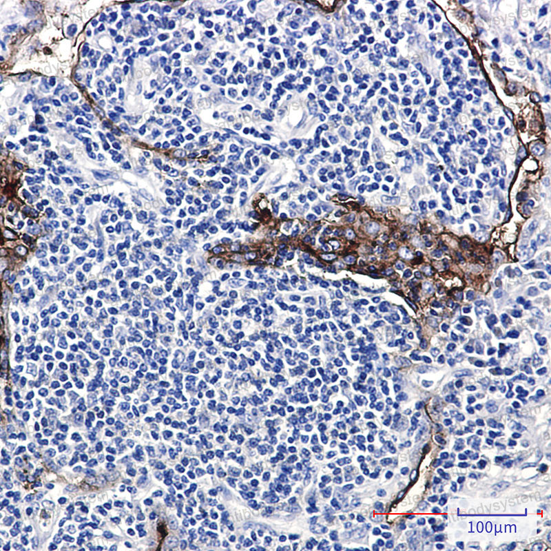 Валидация AntibodySystem RHD10402