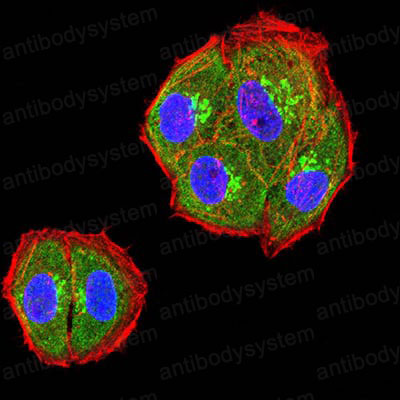 Валидация IF - AntibodySystem RHJ28404
