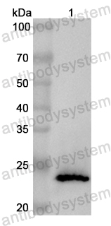 Валидация AntibodySystem PHB69601