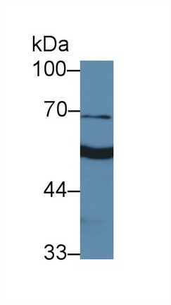 14118