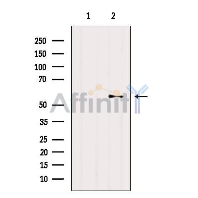 Валидация Affinity AF5447 - 3094