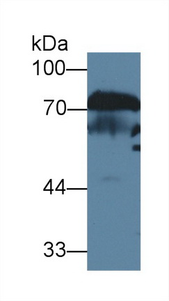 13651