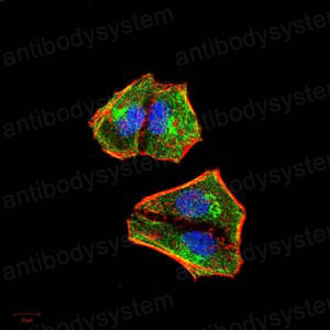 Валидация IF - AntibodySystem RHD69005 (686)