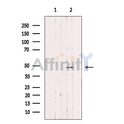 Валидация Affinity DF12391 - 6869