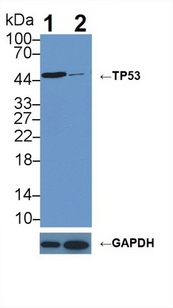 8425